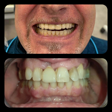 Slider image (3) Dr. Aleksandar Kovacevic - Dental Clinic in Croatia